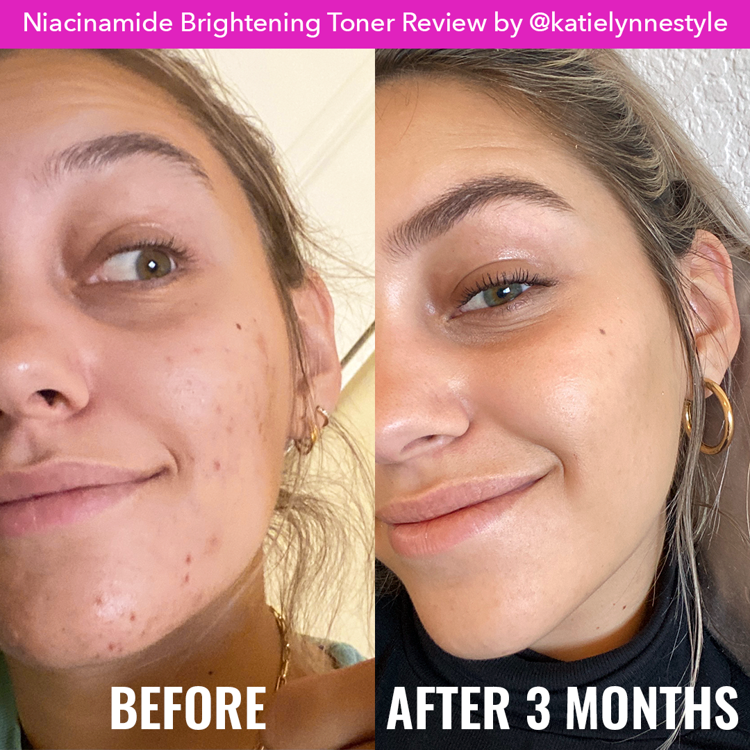 NIACINAMIDE BRIGHTENING TONER 120 ML - GOOD MOLECULES